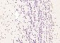GALM Polyclonal Antibody
