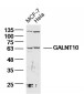 GALNT10 Polyclonal Antibody