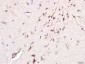 Giantin Polyclonal Antibody