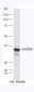 HOXD8 Polyclonal Antibody