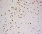 ZMYM2 Polyclonal Antibody
