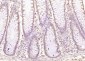 ZMYM2 Polyclonal Antibody