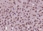 IKAP Polyclonal Antibody