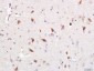 Optineurin Polyclonal Antibody