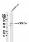 CERD4 Polyclonal Antibody