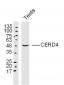 CERD4 Polyclonal Antibody