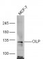 CILP Polyclonal Antibody