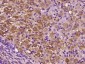 CILP Polyclonal Antibody