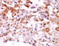 COPZ2 Polyclonal Antibody