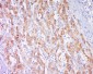 CPNE1 Polyclonal Antibody