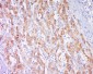 CPNE1 Polyclonal Antibody