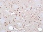 CPNE1 Polyclonal Antibody