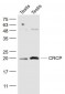 CRCP Polyclonal Antibody