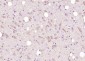 DDX41 Polyclonal Antibody