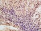 eIF4A3 Polyclonal Antibody