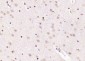eIF4A3 Polyclonal Antibody