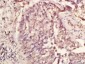CUG-BP1/2 Polyclonal Antibody