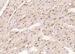 CUG-BP1/2 Polyclonal Antibody
