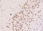 CUG-BP1/2 Polyclonal Antibody