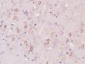 ELMO3 Polyclonal Antibody