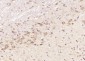 ELP4 Polyclonal Antibody