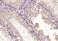 ELP4 Polyclonal Antibody