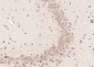 ELP4 Polyclonal Antibody