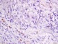 CXCL14 Polyclonal Antibody
