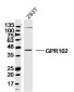 GPR102   Polyclonal Antibody