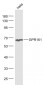 GPR161 Polyclonal Antibody