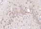 HERPUD1 Polyclonal Antibody