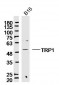 TRP1 Polyclonal Antibody