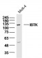 IBTK Polyclonal Antibody