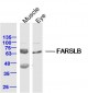 FARSLB Polyclonal Antibody