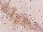 FBXO44 Polyclonal Antibody