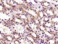 FBXO44 Polyclonal Antibody