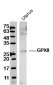GPX8 Polyclonal Antibody