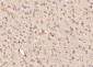 TRBP Polyclonal Antibody