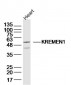 KREMEN1 Polyclonal Antibody