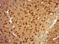 L3MBTL2 Polyclonal Antibody