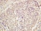 KDM5A Polyclonal Antibody