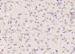 KIF2A Polyclonal Antibody