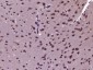 KIF6 Polyclonal Antibody