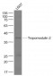 Tropomodulin 2 Polyclonal Antibody