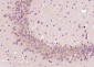 Tropomodulin 2 Polyclonal Antibody
