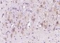 Tropomodulin 2 Polyclonal Antibody