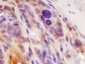 TOMM22 Polyclonal Antibody