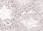 METTL3 Polyclonal Antibody
