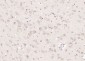 METTL3 Polyclonal Antibody