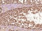 MSH4 Polyclonal Antibody